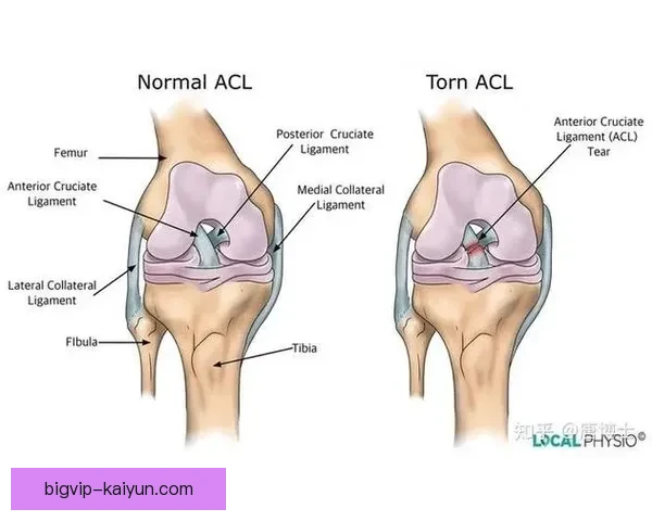 加维十字韧带康复进展持续向好，状态逐步回暖引发关注